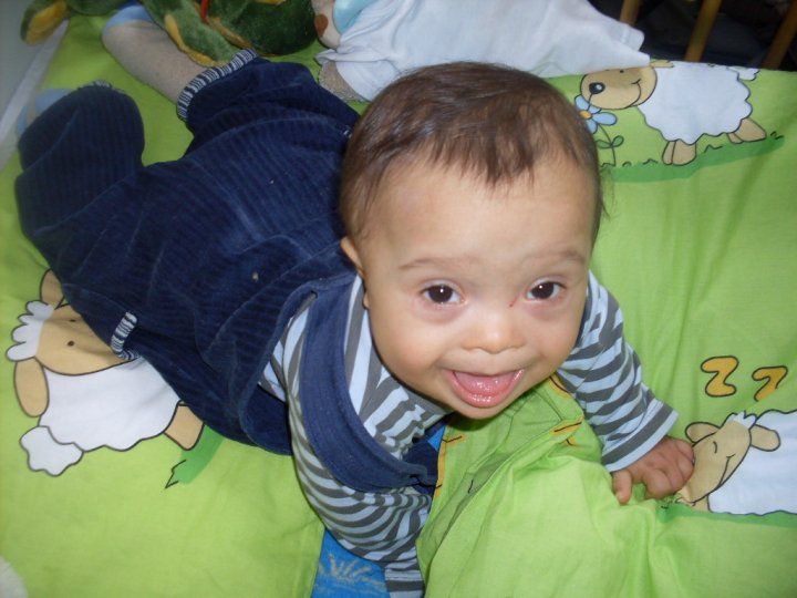 Hospitals not doing enough to advise parents of babies with Down syndrome