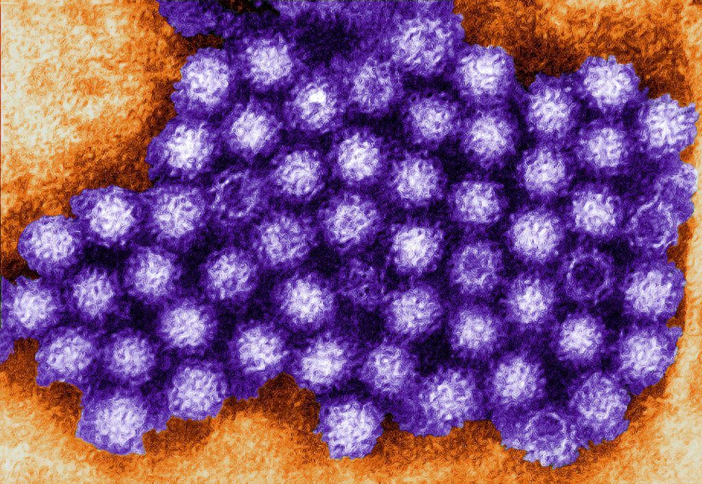 Improved testing methods help in fight against novovirus stomach bug