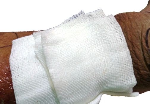A new whistle-blowing plaster could cut post-op infections – and costs