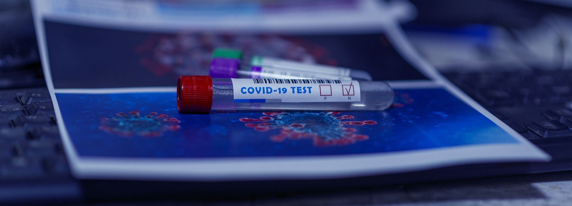 Coronavirus Round-Up: Highest daily coronavirus infection rate since mid-May