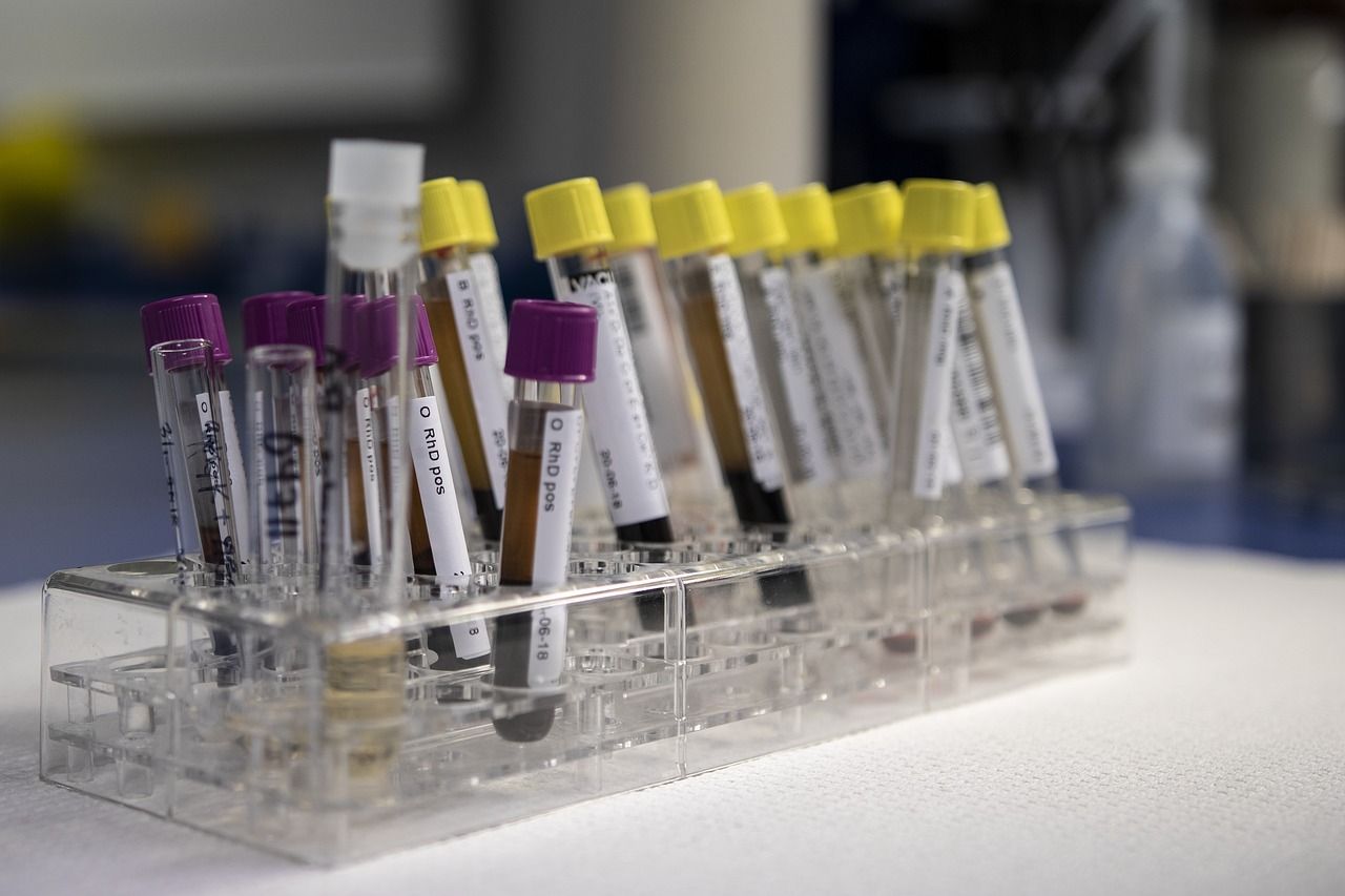Science Round-Up: SSI caught in blood bank scandal